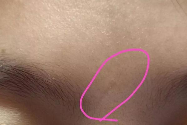 男人印堂发红的命运解析，揭示生活中的隐秘真相！