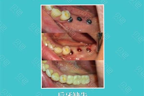 门牙缝隙大揭秘：你是否知道它背后的命理故事？