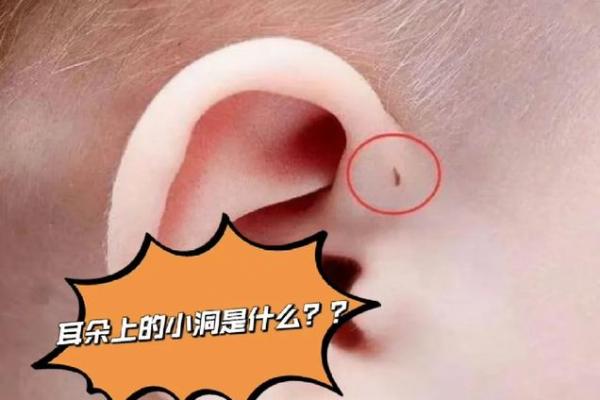 女孩耳垂与命运：揭示两个耳仓背后的秘密与启示