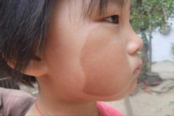 胎记与命运：揭秘女人胎记背后的真实寓意与人生轨迹