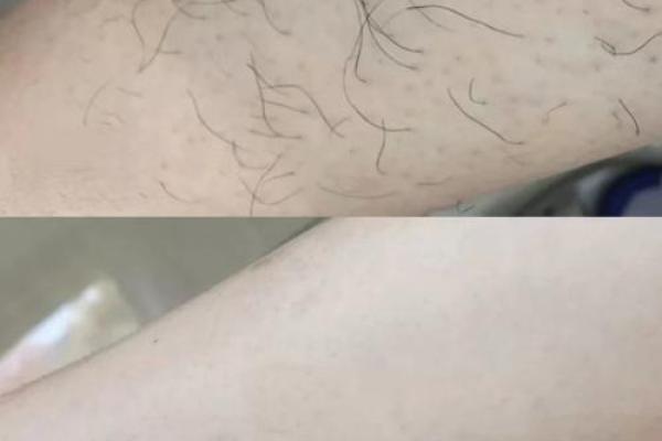 没有腿毛的男生，究竟是什么命运？