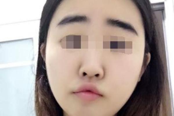 探秘印堂凹陷：面相学中的命运密码与深藏的智慧