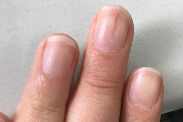 男人手上的指甲与命运的关系解析：揭开隐藏的秘密