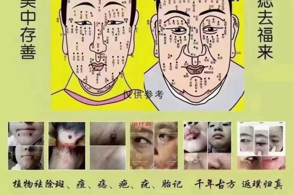 眉头两颗痣的命运解析：揭示你的人生轨迹与性格特征