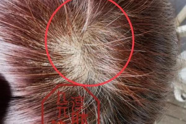 女人头发秃背后的秘密：命运与自信的双重考验
