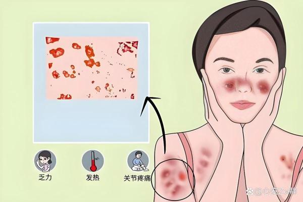 探秘发烧的秘密：身体的自然警报与免疫反应
